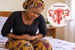 Règles douloureuses : et si c’était de l’endométriose ?